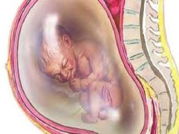 Tiêu chuẩn chẩn đoán tắc mạch ối