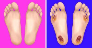 Dấu hiệu bệnh tật thông qua thay đổi của bàn chân