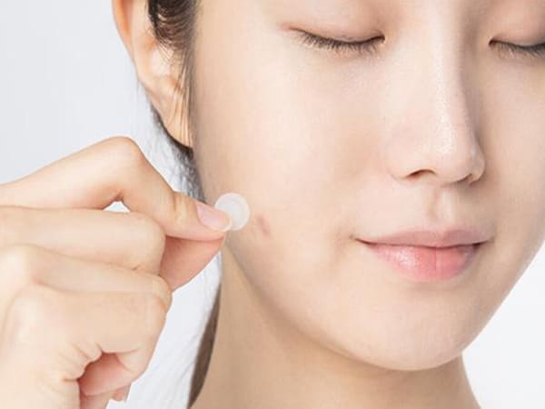 Những cách che mụn không sử dụng trang điểm khác