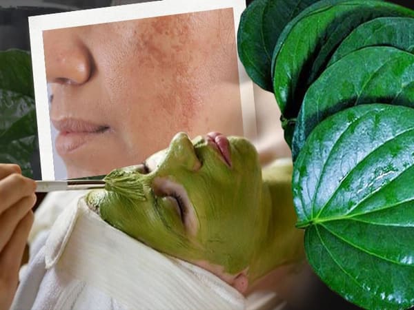 Làm đẹp bằng lá trầu không cách trị nám, tàn nhang
