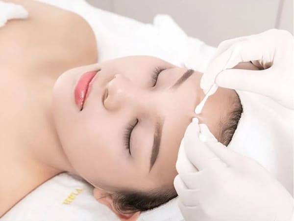 Có nên nặn mụn không 