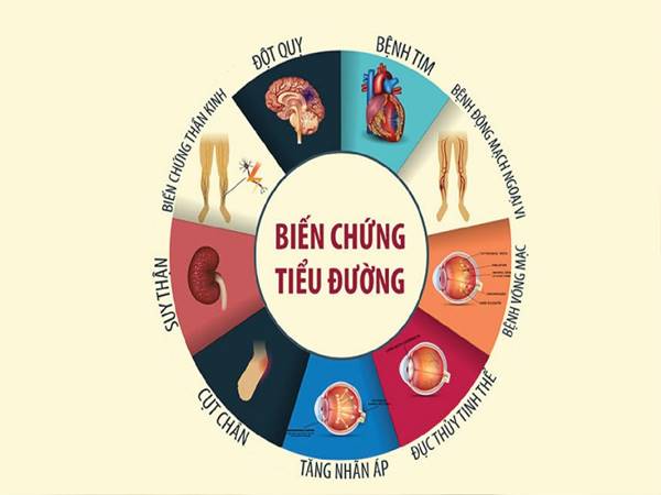 tieu-duong-bao-lau-bien-chung