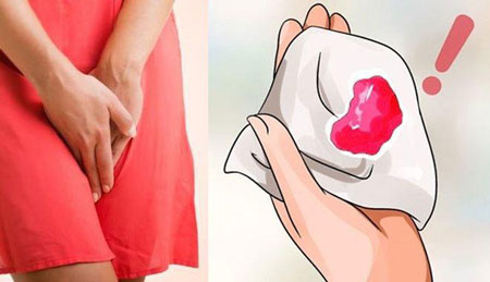 Đau bụng dưới
